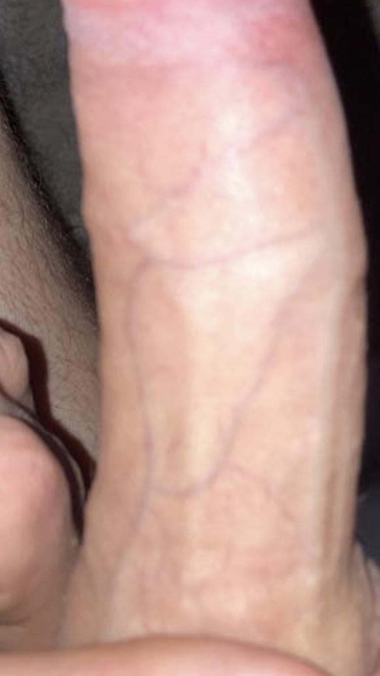 daviderlacher Live Image