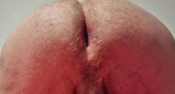 penis562 Live Image