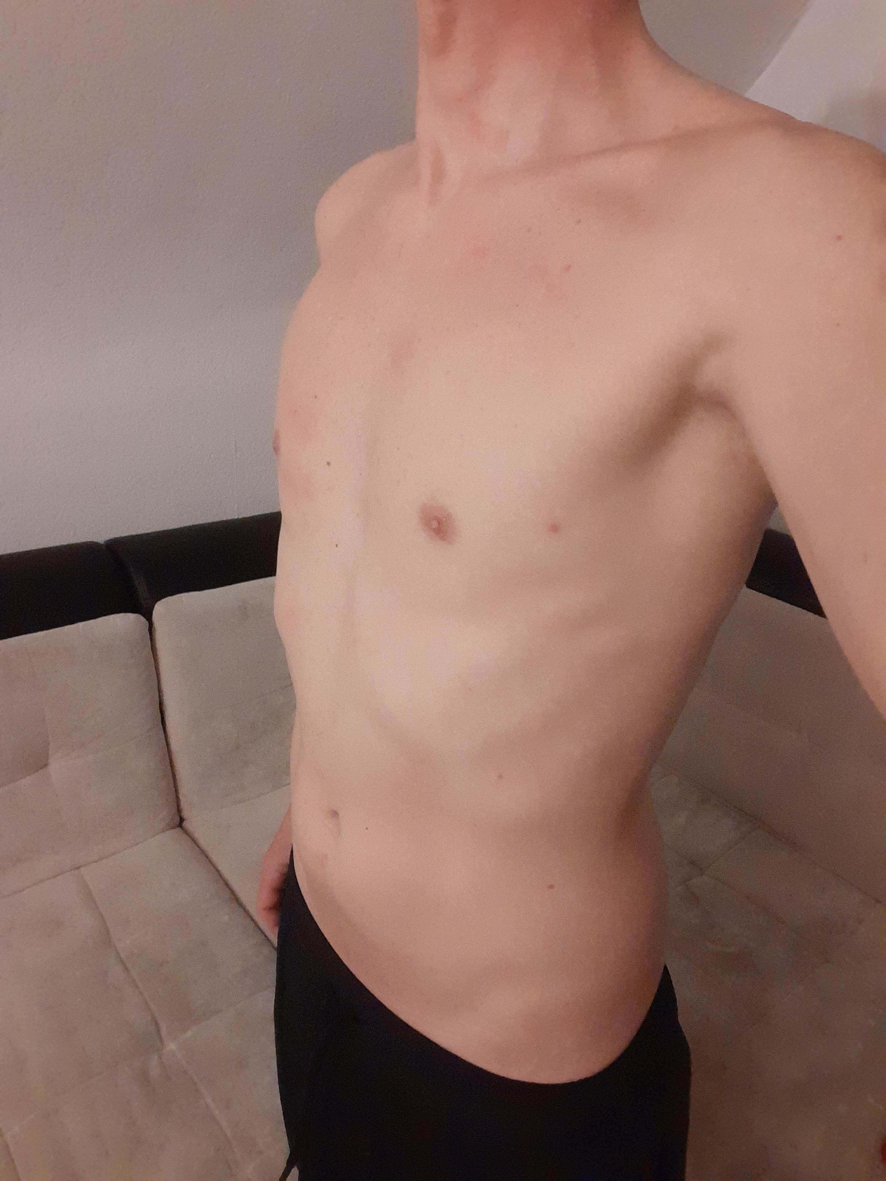 Nymphofux live from Germany